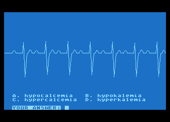 EKG Teaching atari screenshot