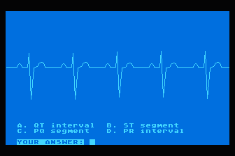EKG Teaching