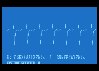 EKG Teaching