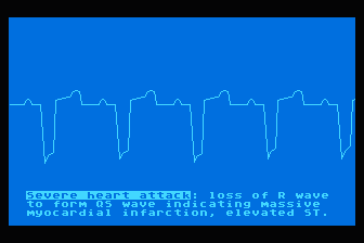 EKG Teaching atari screenshot