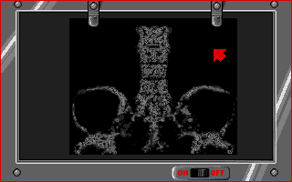 Life and Death atari screenshot